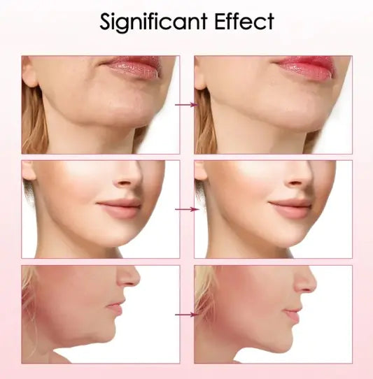 Rejuvenate Your Skin with the V15 Facial Lifting Device